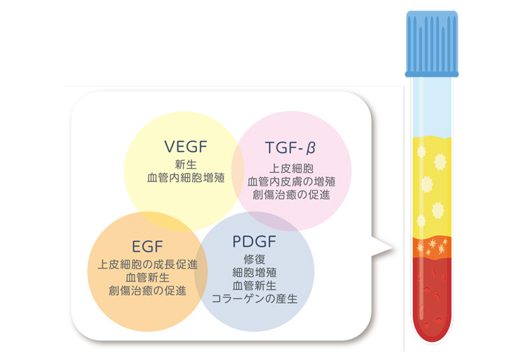 PRP(Platelet Rich Plasma)療法=多血小板血漿療法